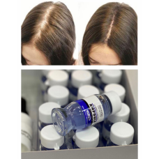 Ампулы от выпадения волос Imonpro Losing Control Ampoule Professional