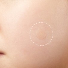 Антибактериальные наклейки против прыщей Cosrx Acne Pimple Master Patch
